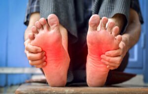 Diabetic Neuropathy