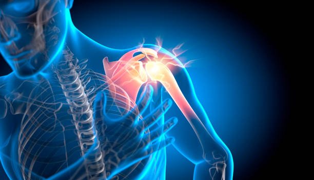 Shoulder Pain